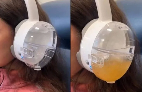 disposable silicone ear irrigation tips